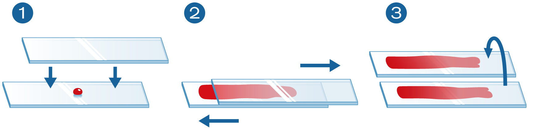 Illustration Methode zur Probenentnahme mittels Squash